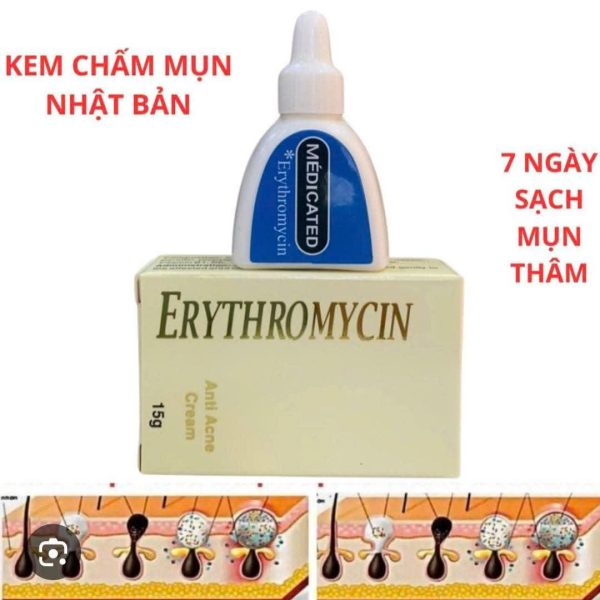 Kem Erythromycin Nhật Bản NH45
