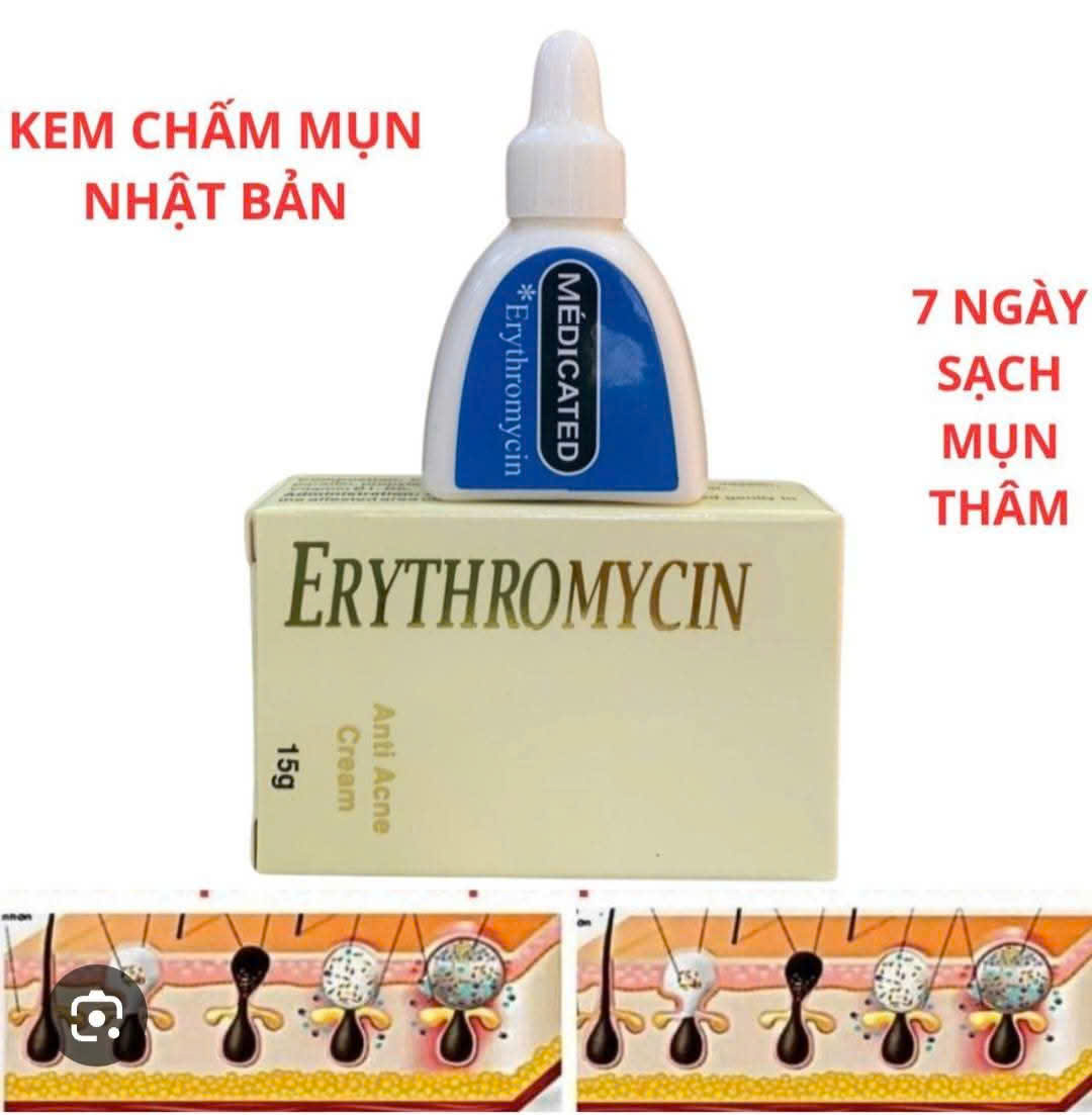 Kem Erythromycin Nhật Bản NH45